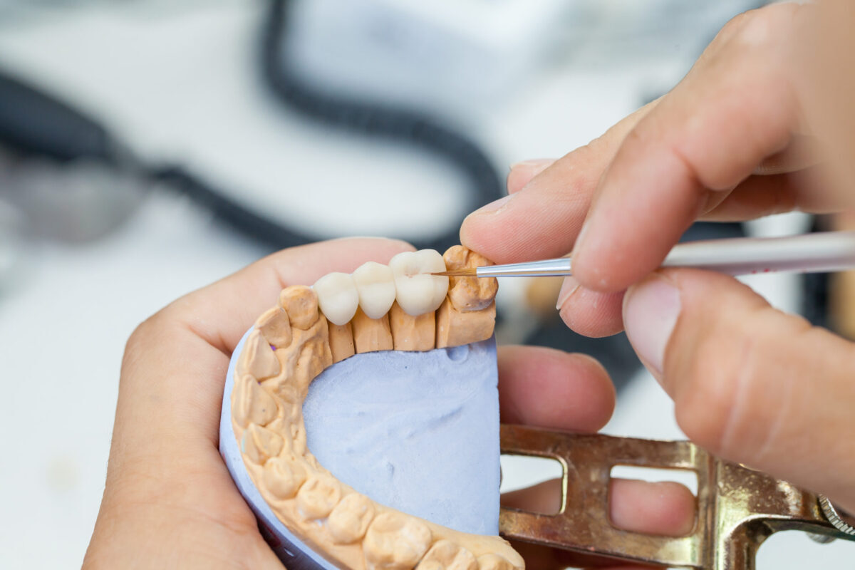 What Is the Purpose of Restorative Dentistry?